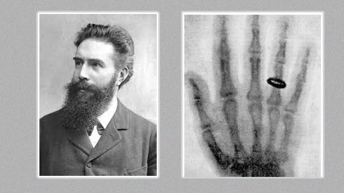 PhilosophyOfPhy's tweet image. Wilhelm Conrad Röntgen’s discovery of X-rays in 1895 opened an entirely new window into the unseen world.

At the end of the nineteenth century, physics was largely concerned with visible phenomena, and the idea of penetrating radiation was unimaginable. While experimenting with