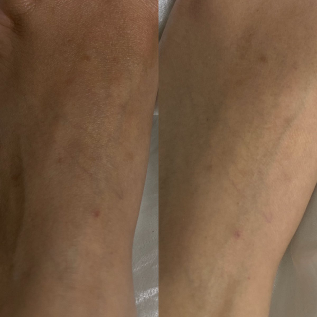 ⋆⭒bie˚.⋆ tweet media