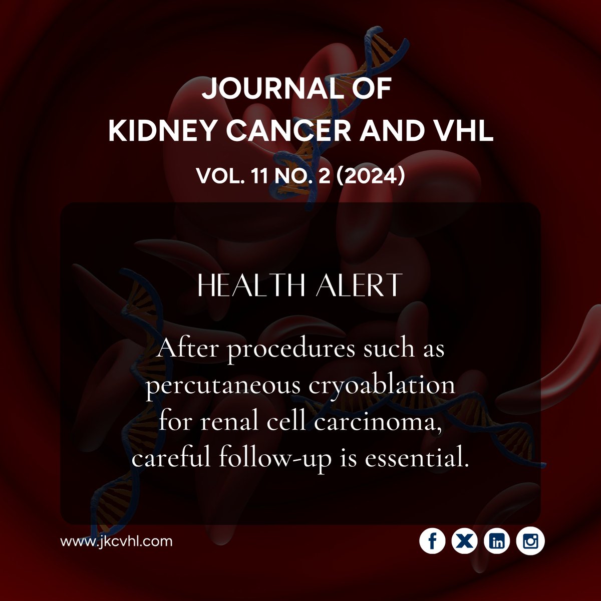 Jokcov's tweet photo. After percutaneous cryoablation for RCC, vigilant follow-up is crucial. Rare complications like portal venous thrombosis highlight the need for early imaging and clinical monitoring to ensure patient safety.

Read more: https://t.co/SetWEEU0IA

#KidneyCancer #RCC #OncologyCare https://t.co/nC6aGa89DG