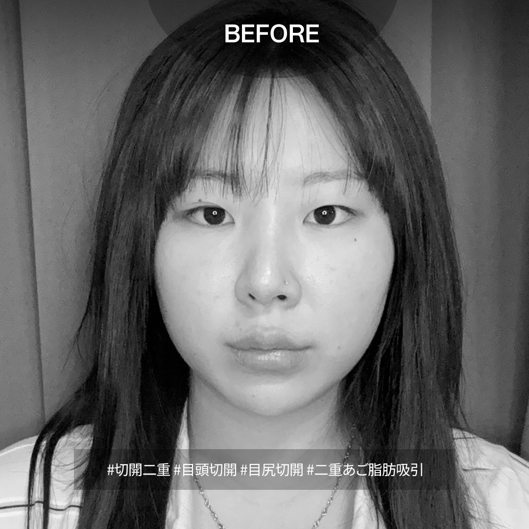 ルーヴル美容外科 tweet media