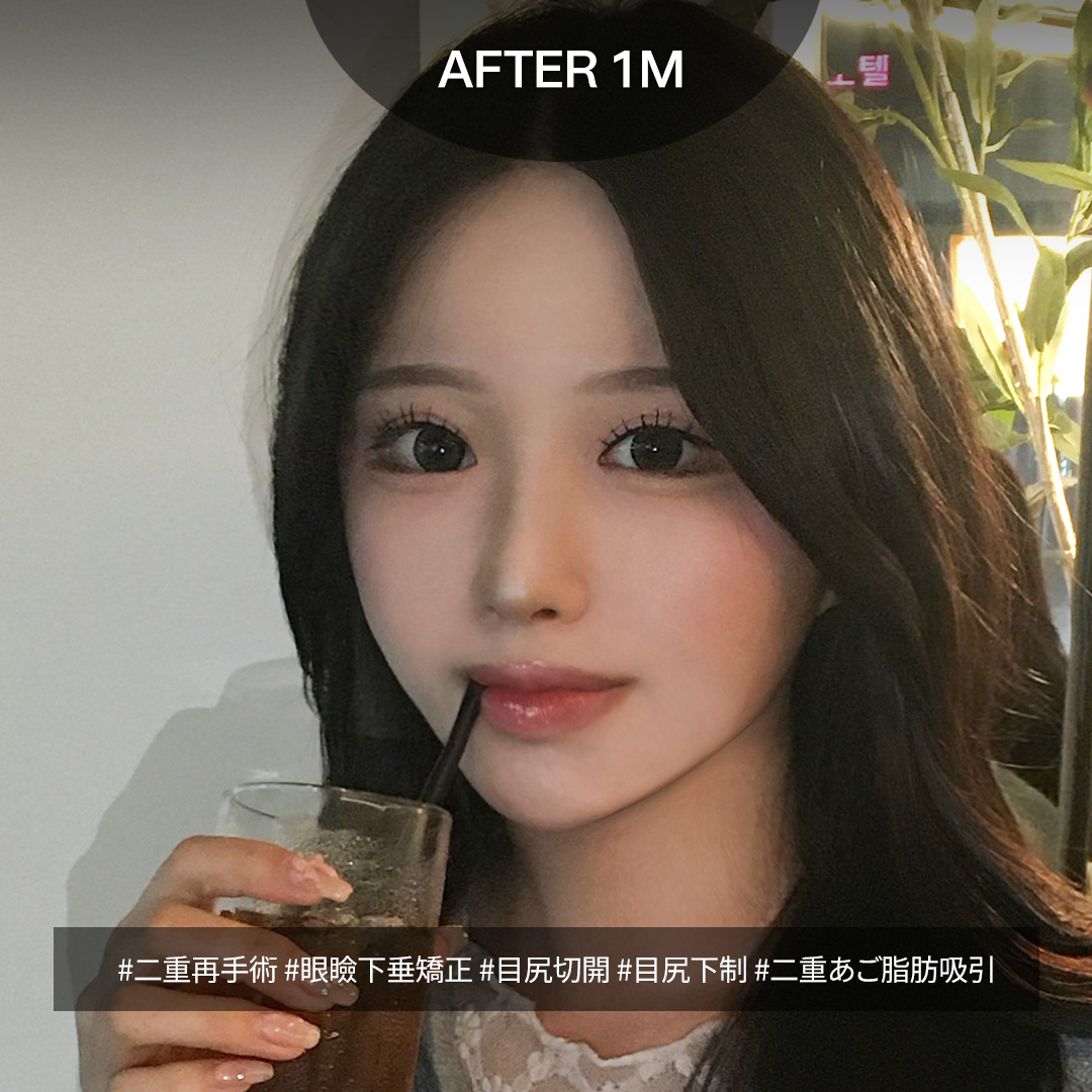 ルーヴル美容外科 tweet media