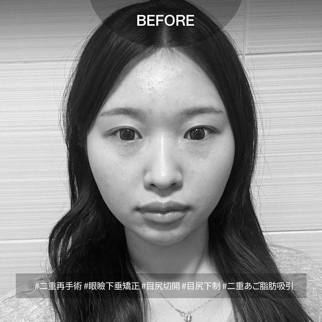 ルーヴル美容外科 tweet media