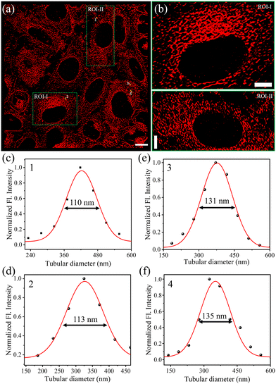 ckn_lab_IIT's tweet photo. Our recent work on the development of another class of Zn-complex for SRM imaging of ER is online now at Dalton Transactions. We are excited about the results and curious to see your feedback. 👉https://t.co/IUdc0caay5
Congratulations to Abdul and other contributing authors. https://t.co/ELvHgovt9r