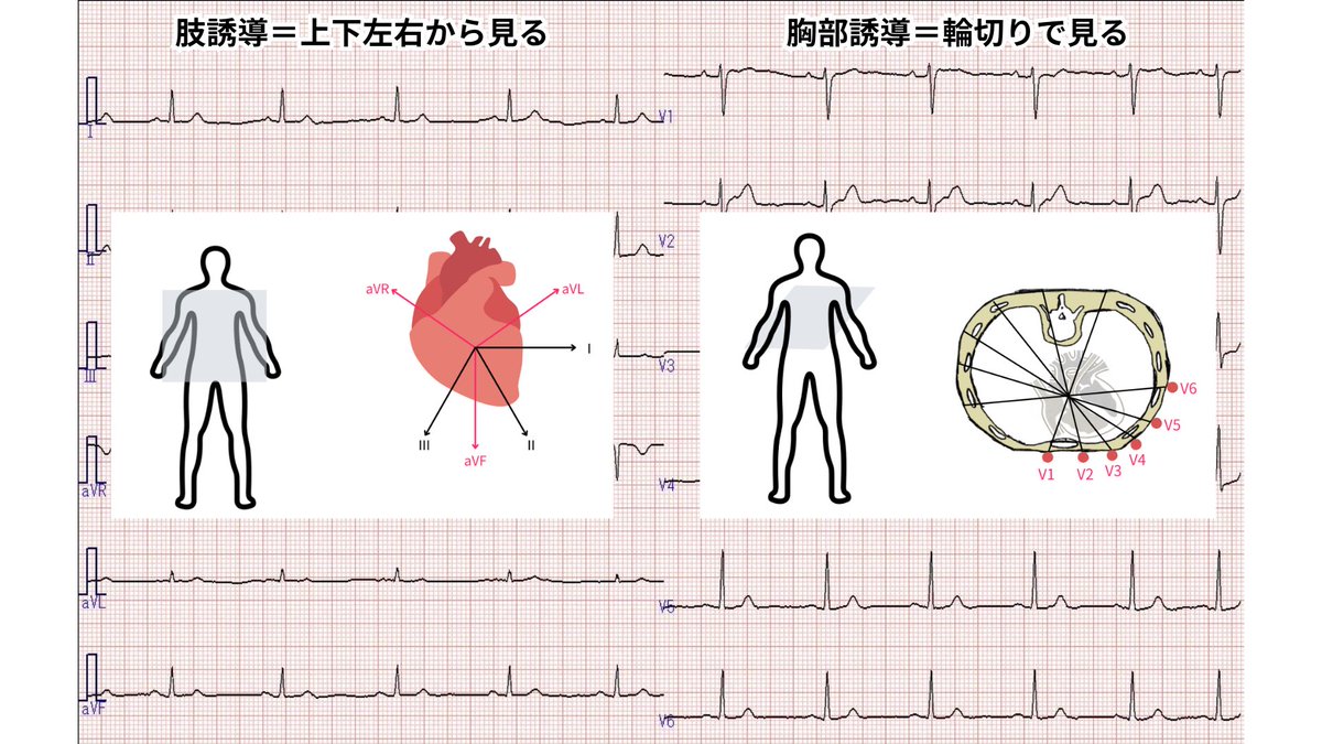 心電図くま | ECG KUMA tweet media
