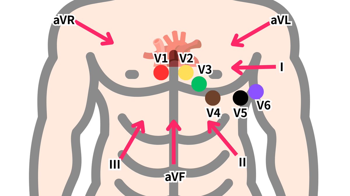 心電図くま | ECG KUMA tweet media