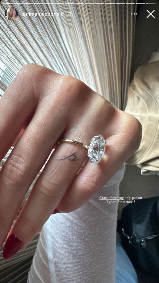 herhush_'s tweet photo. my fingers in 5 years https://t.co/kN2OQchTf5