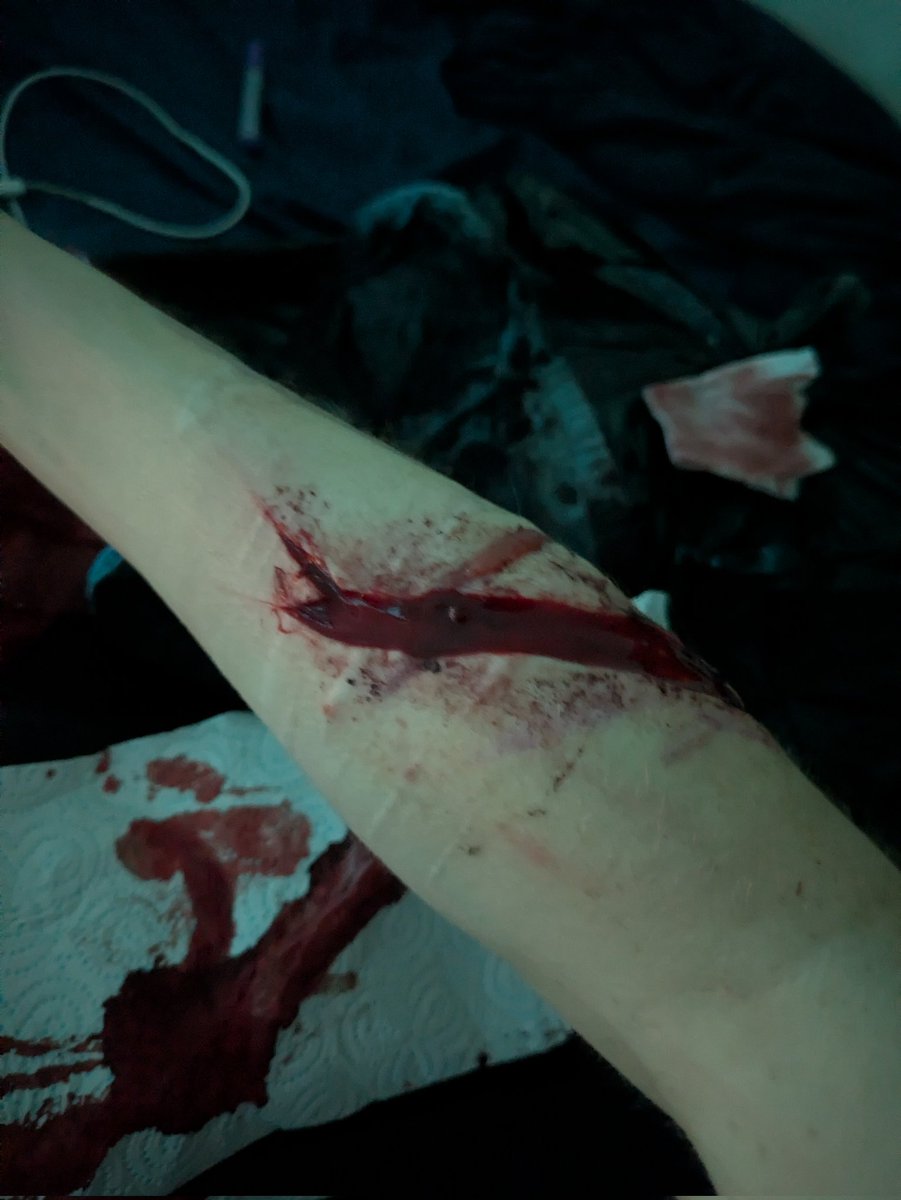 Axel ◇sh(ed)twt◇ tweet media