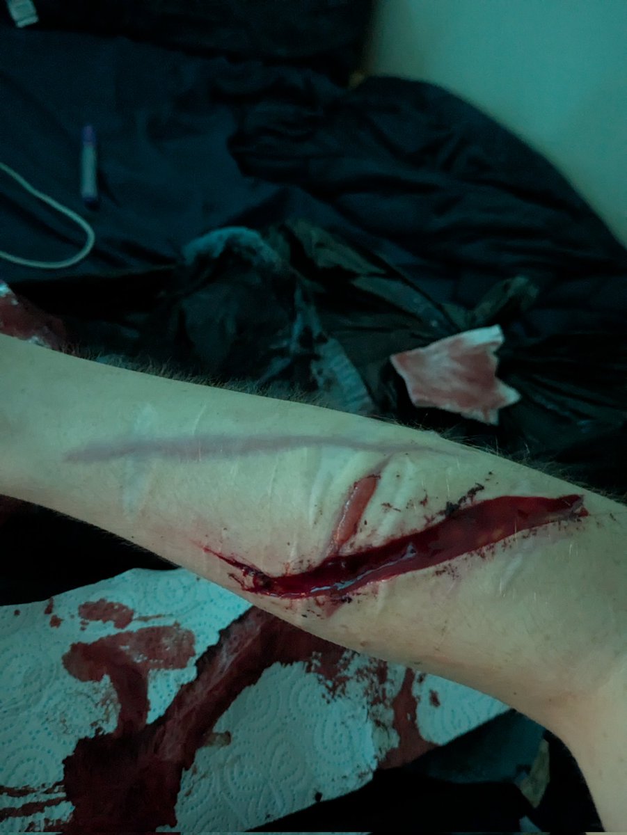 Axel ◇sh(ed)twt◇ tweet media