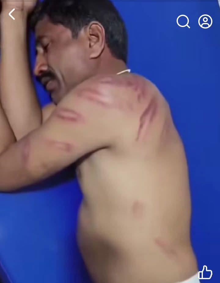 भीमटासुर 💙 tweet media