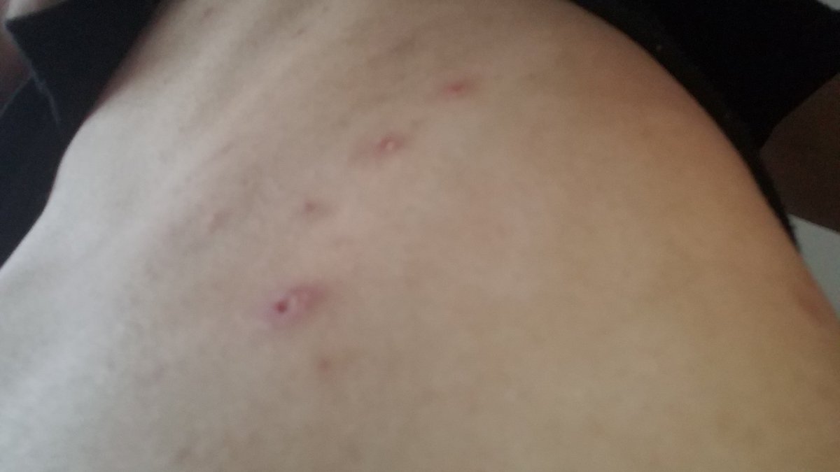 根掛かりマイスター コマイちゃん(復活のK) tweet media