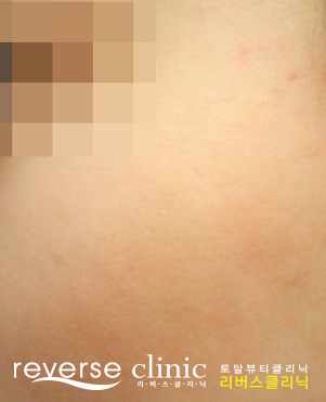 【公式】リバースクリニック | 江南・明洞・弘大 tweet media