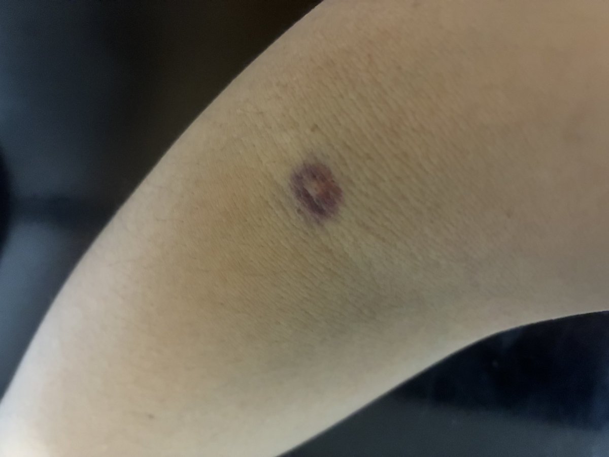 慎仁🍓🤍 tweet media