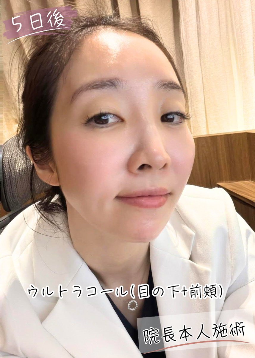 ビヨンド クリニック🤍フィラー・リフティング・アンチエイジング専門🪷 tweet media