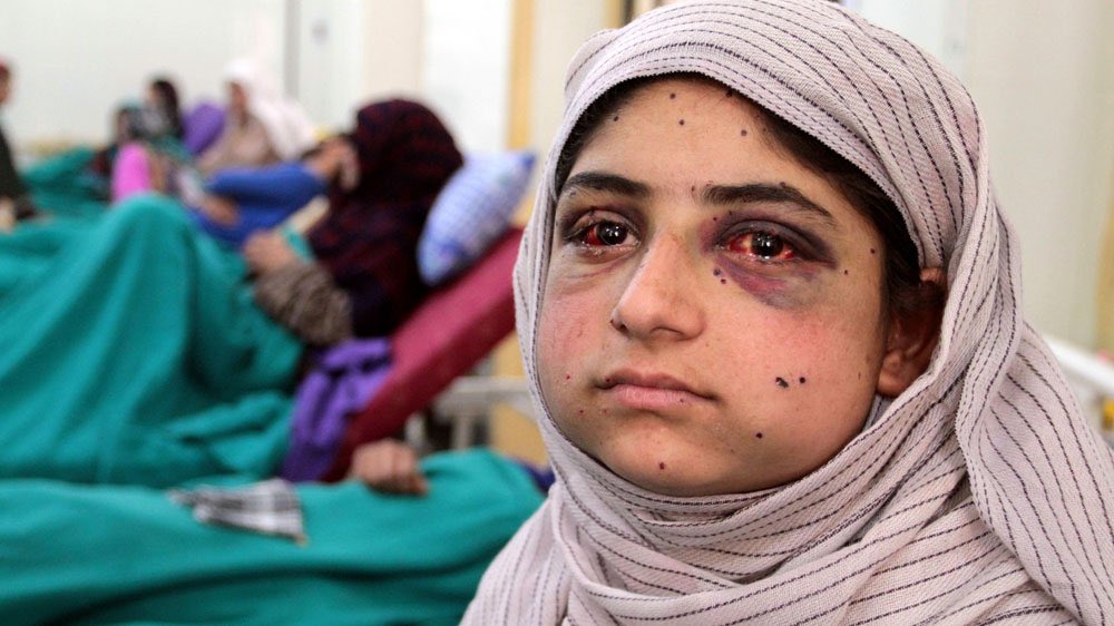 Black Bird tweet media