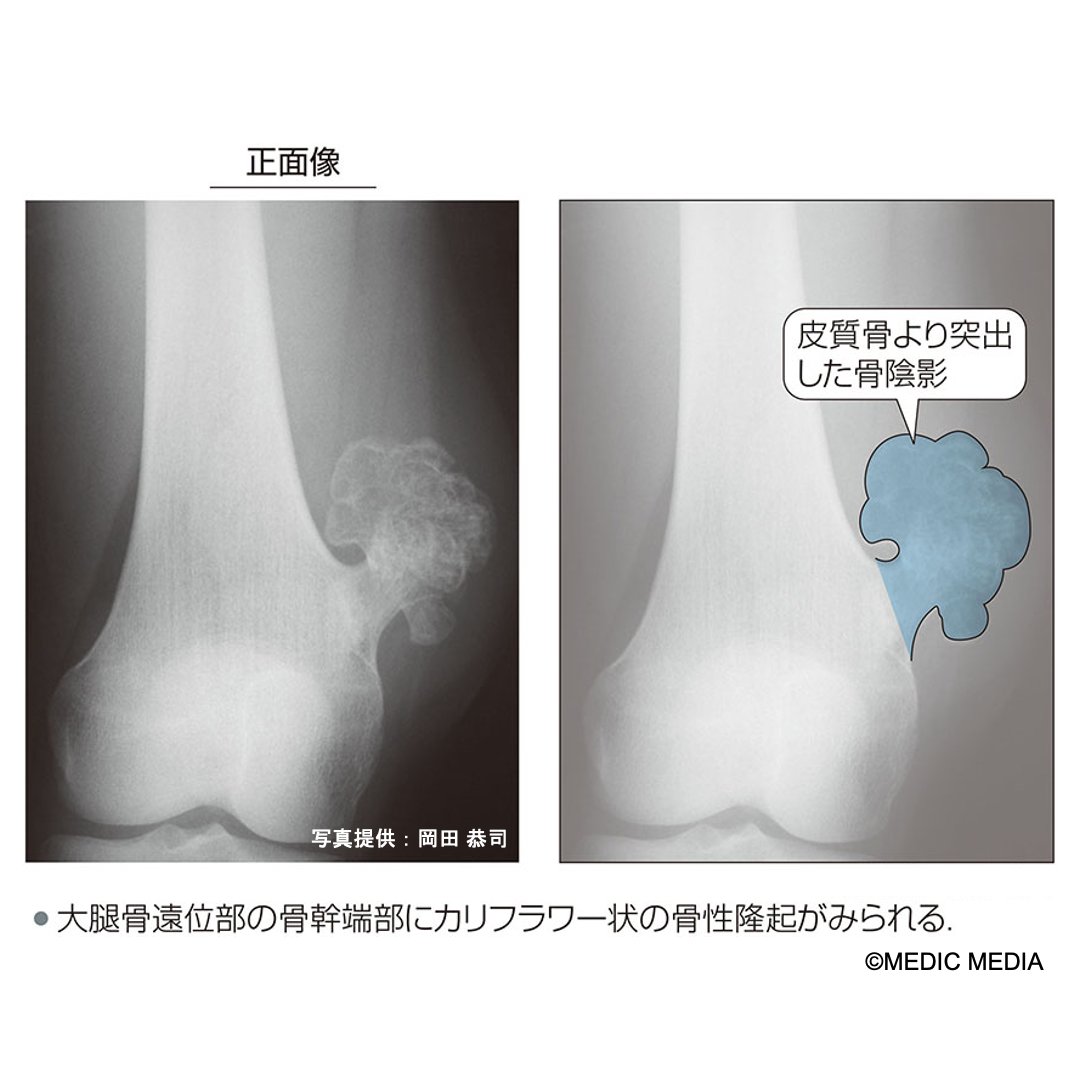 病気がみえる tweet media