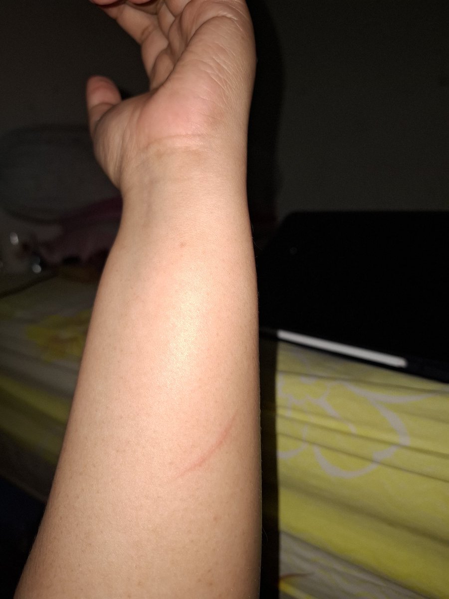 AREE 🌼 tweet media