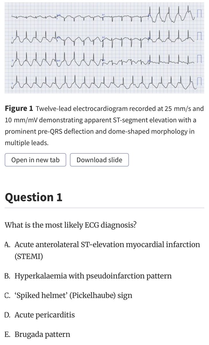 European Society of Cardiology Journals tweet media