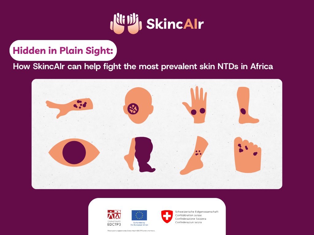 SkincAIr project tweet media