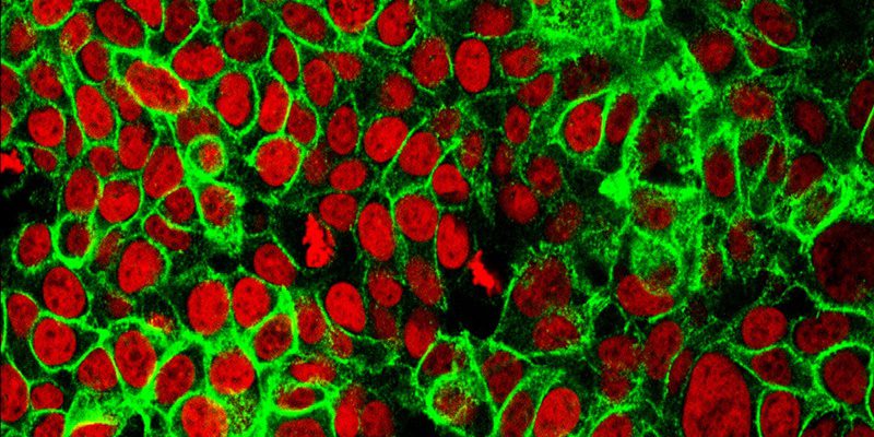 2 Minute Medicine® tweet media