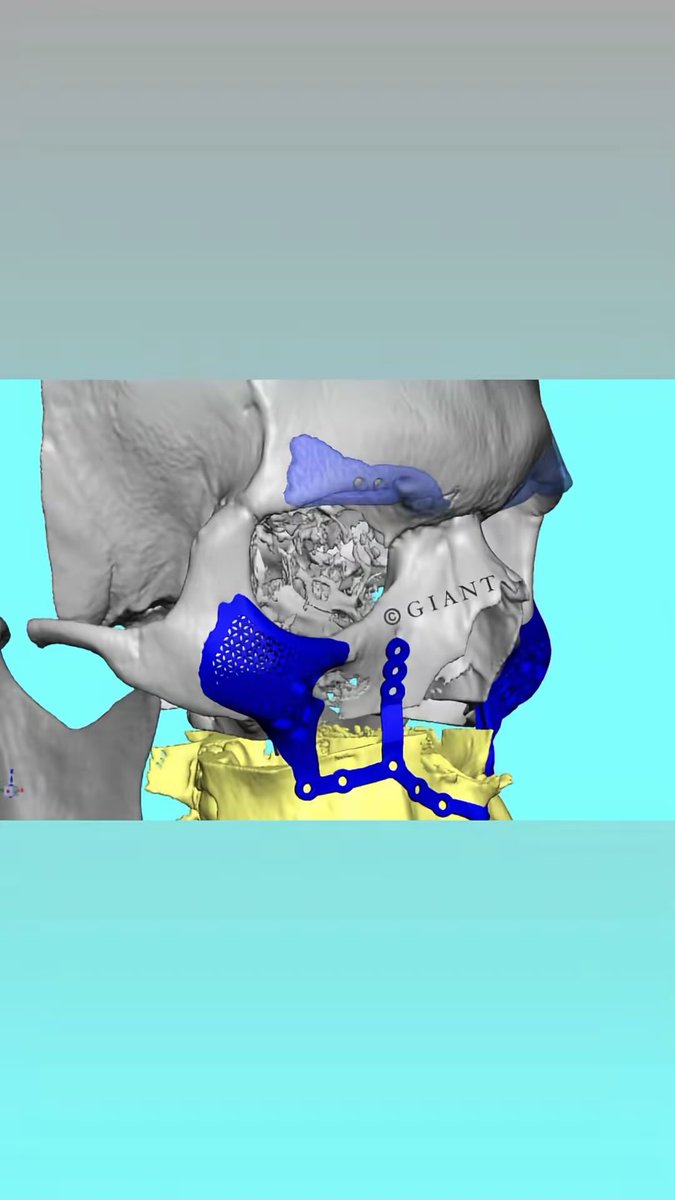 Omarbrah tweet media