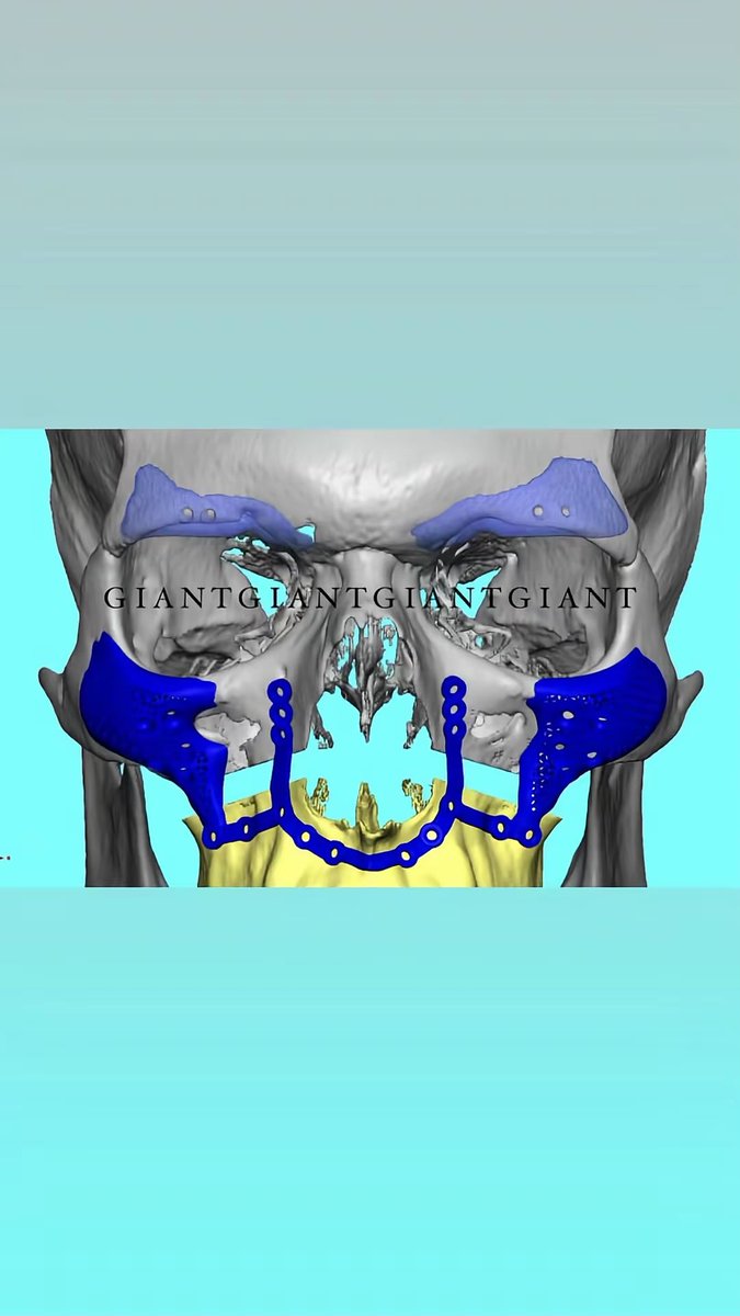 Omarbrah tweet media