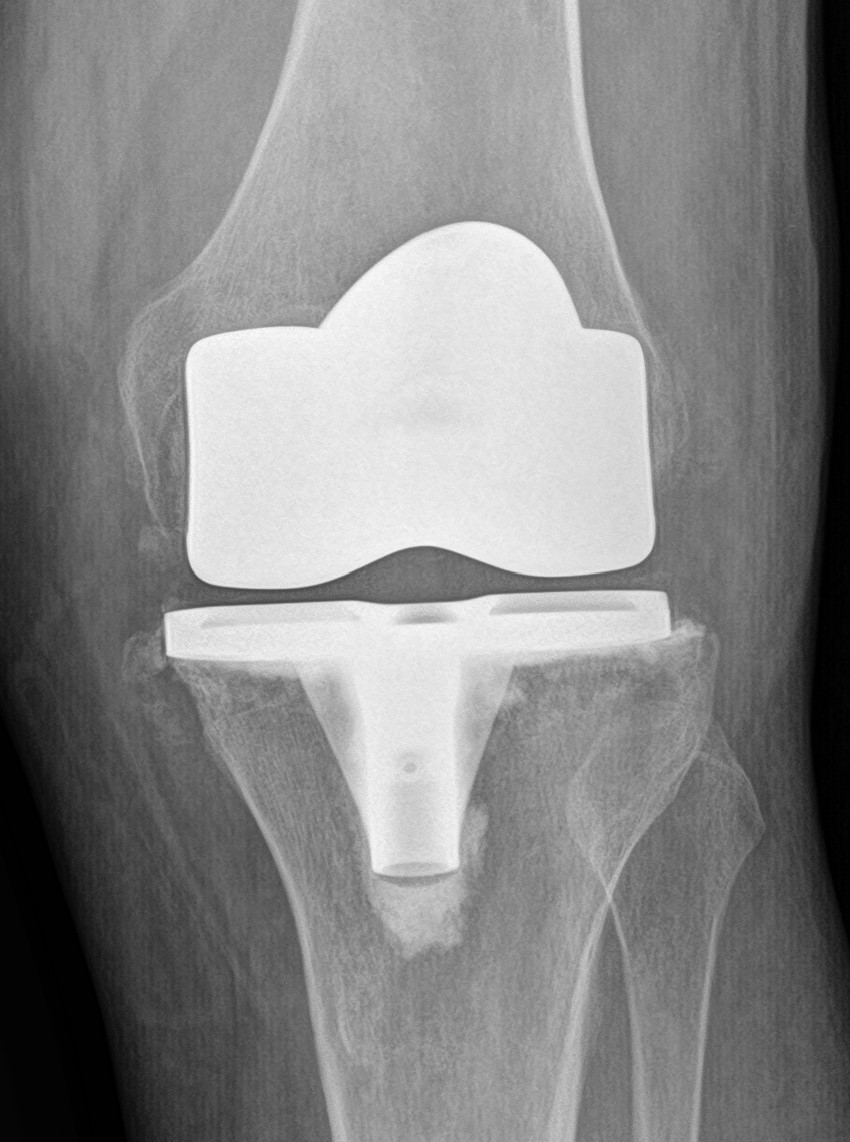 18B_ACTUAL tweet media