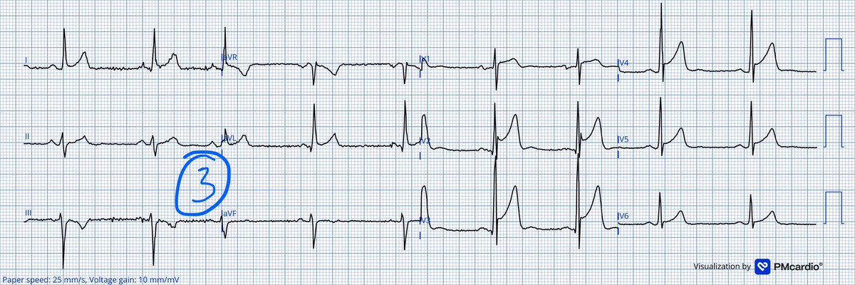 Jack Cahill tweet media