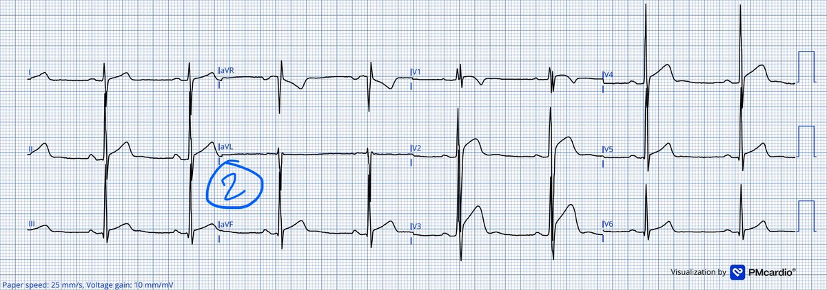 Jack Cahill tweet media