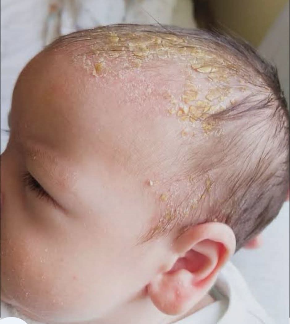 Rozana 𓂆🍉🇵🇸 tweet media