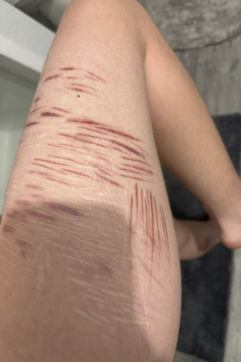 ♟️Kinger of SHEDtwt♟️(comms open) tweet media