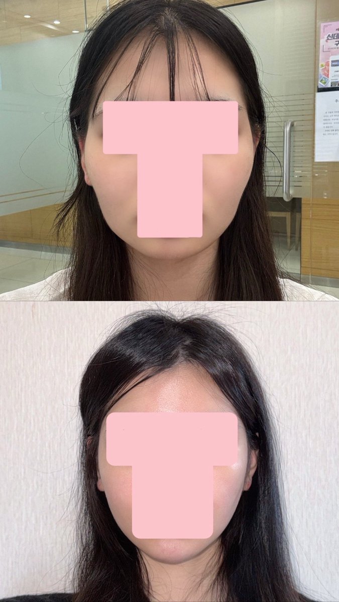 きー@骨切り鼻フルDT tweet media