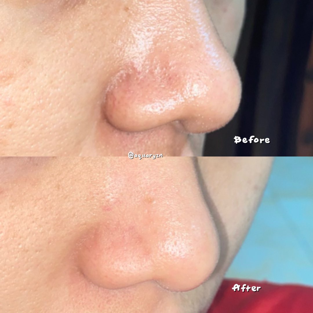 aquaryzn tweet media