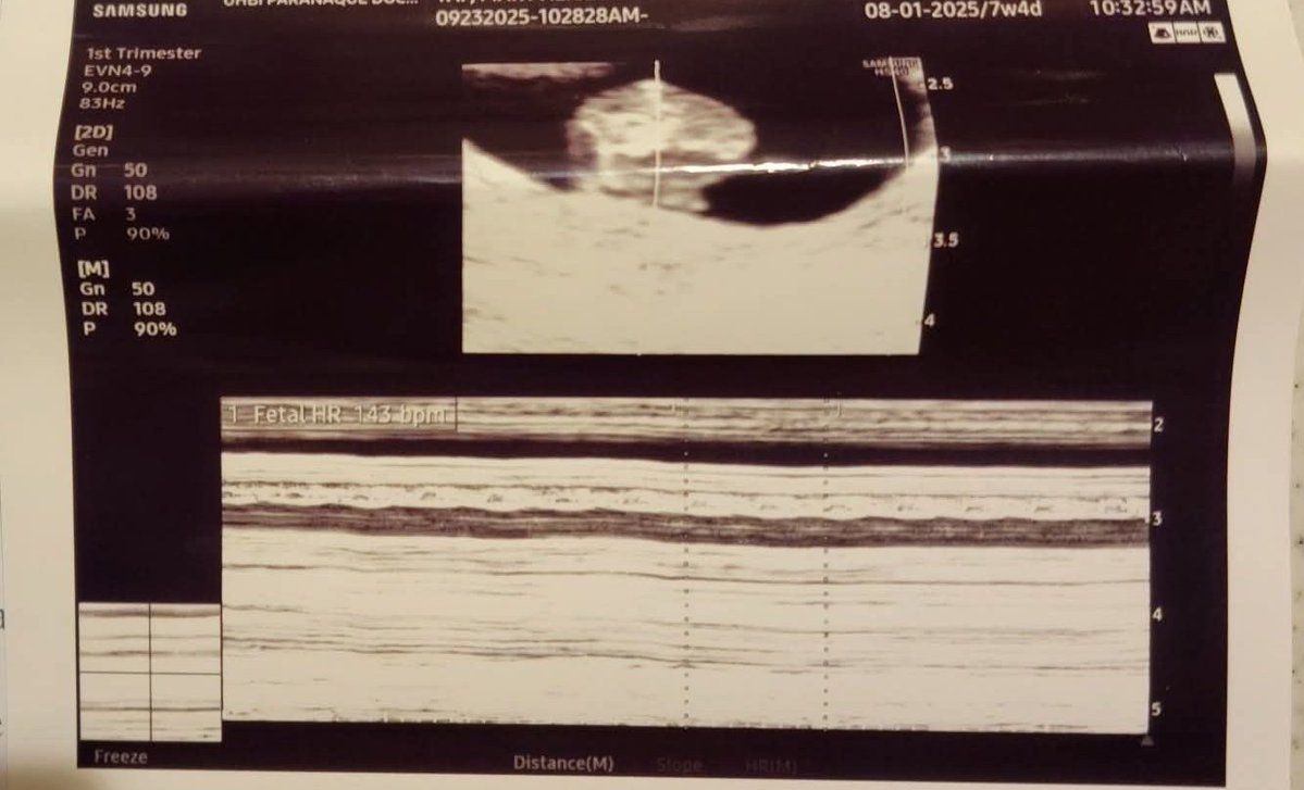 ✧ alice // ✧ tweet media