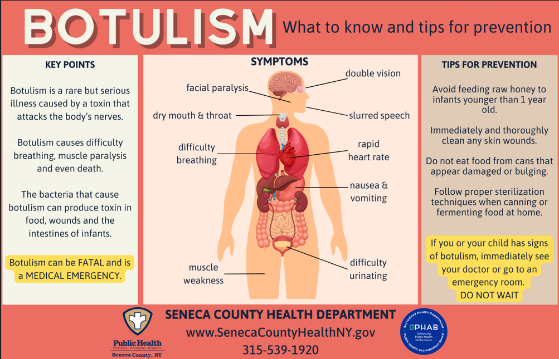 SenecaCountyDOH's tweet photo. Botulism is a rare but serious illness that is caused by a toxin that attacks the body’s nerves.

Recently a recall was issued for improperly stored garlic at risk for contamination with botulism.

For more information: https://t.co/lv6T805agr. https://t.co/Hkbu68B1aq