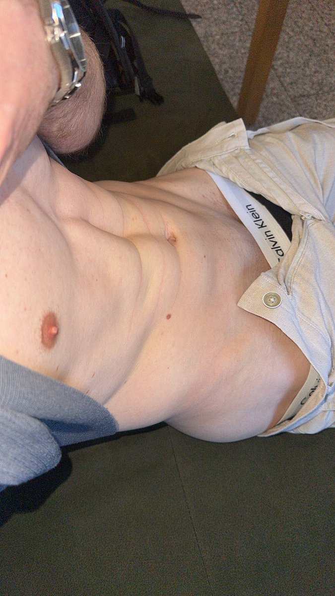 fabi_twink tweet media