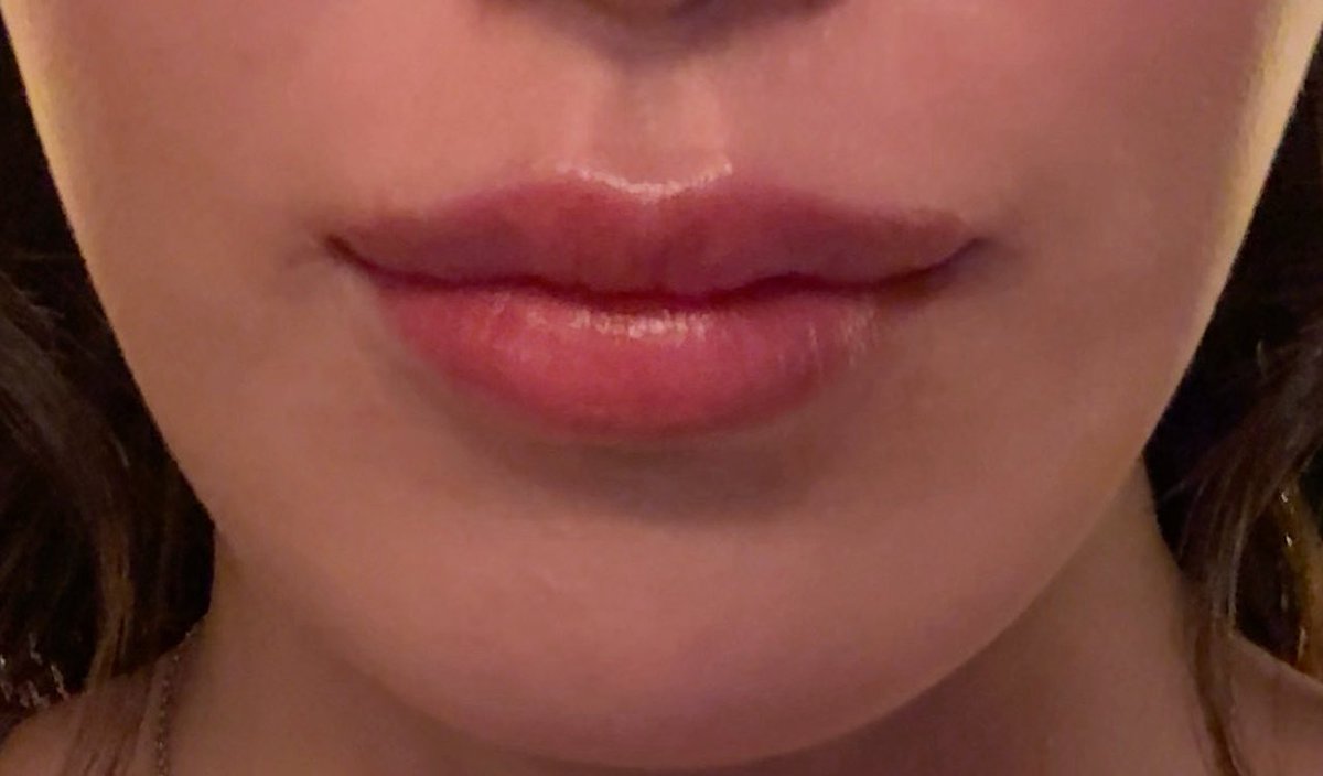 チバンちゃん tweet media