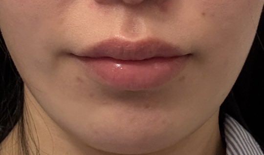 チバンちゃん tweet media