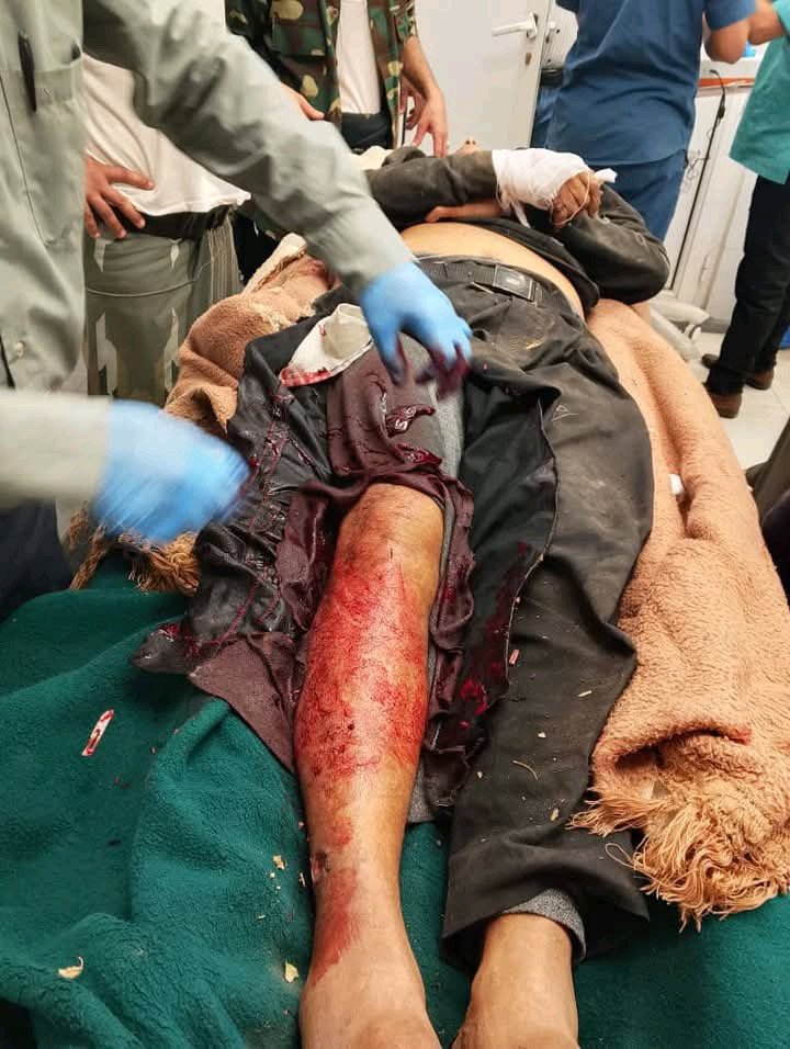 alorayemen1's tweet photo. الأن 
إستشهاد العم / محمد فرحان  ( تعز ) 
٧٠ عاماً على يد قناص حوثي !!! 

حسبي الله ونعم الوكيل . https://t.co/mf01SHbCLC