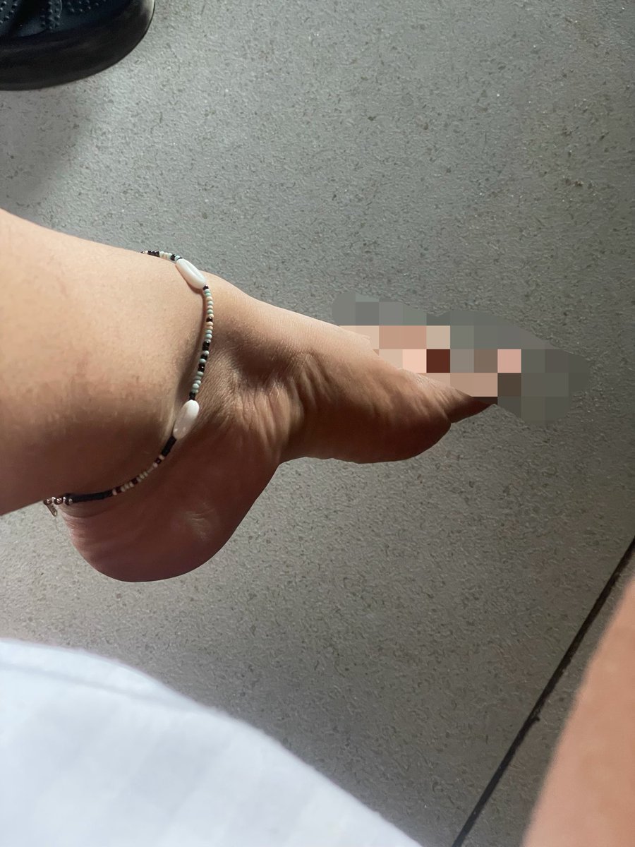 serveicy's tweet photo. got this cute anklet at the beach 🏝️ https://t.co/vkdM8yZpEJ