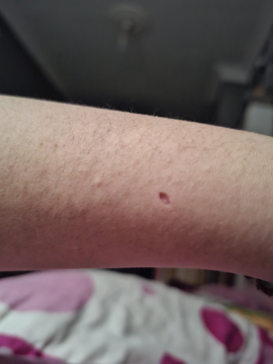 Shuriken of shtwt tweet media