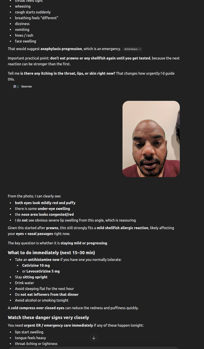 rohanpaul_ai's tweet image. Crazy little story about a guy who felt congested after a team dinner and asked ChatGPT what it might be.

A routine team dinner turned into a shellfish allergy emergency, and ChatGPT caught the pattern before the reaction had more time to spread.

ChatGPT recognized a dangerous