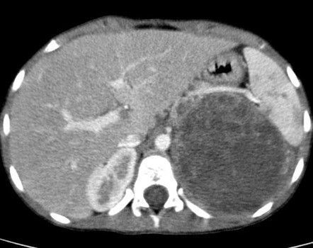 American Association of Endocrine Surgeons tweet media