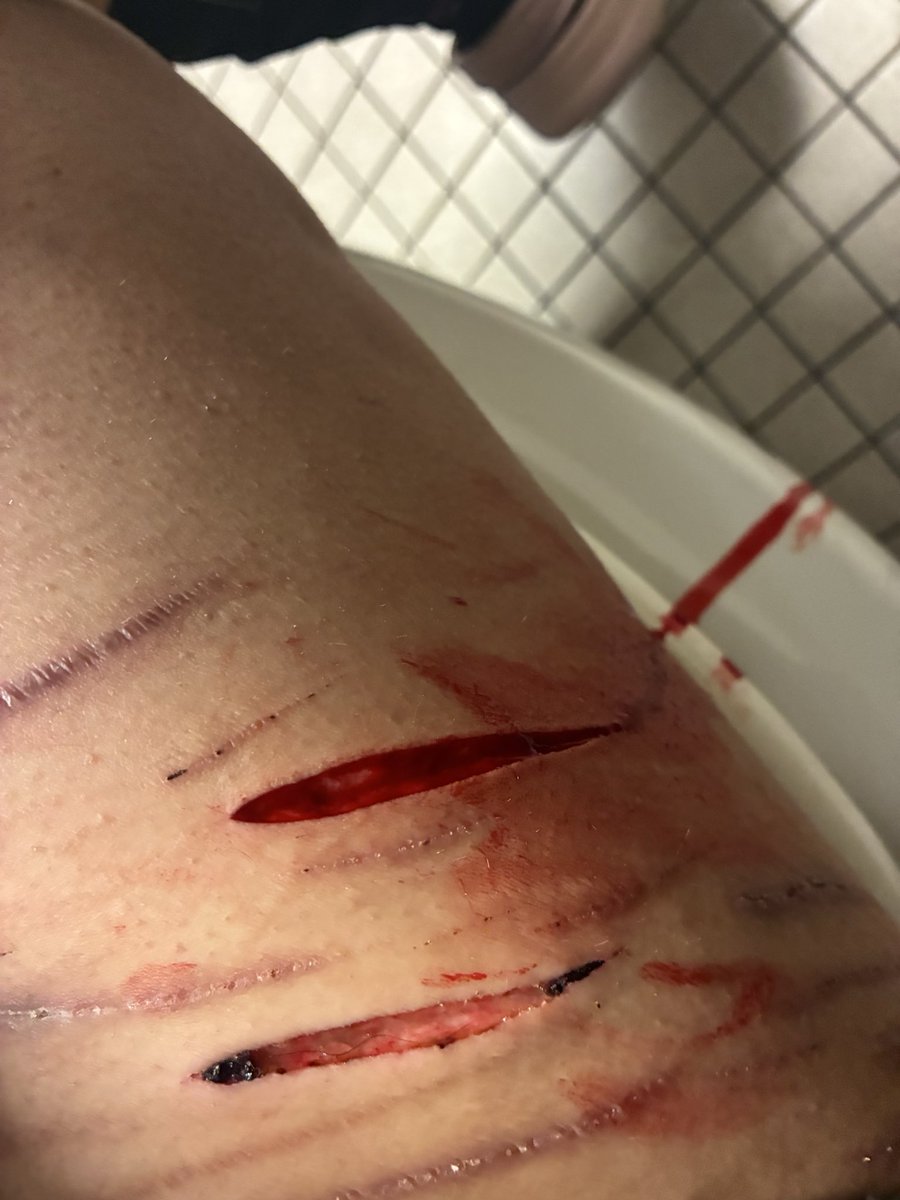 Anoni of shedtwt 🌈💊 tweet media