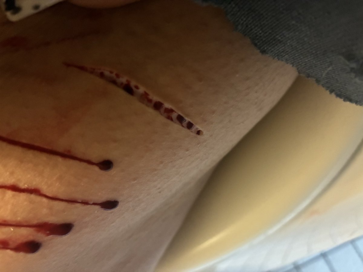 Anoni of shedtwt 🌈💊 tweet media