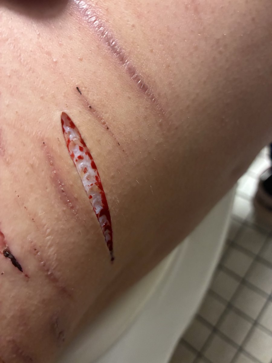 Anoni of shedtwt 🌈💊 tweet media