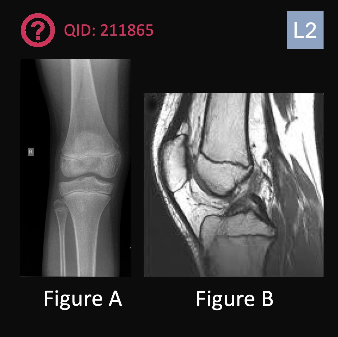 Orthobullets tweet media