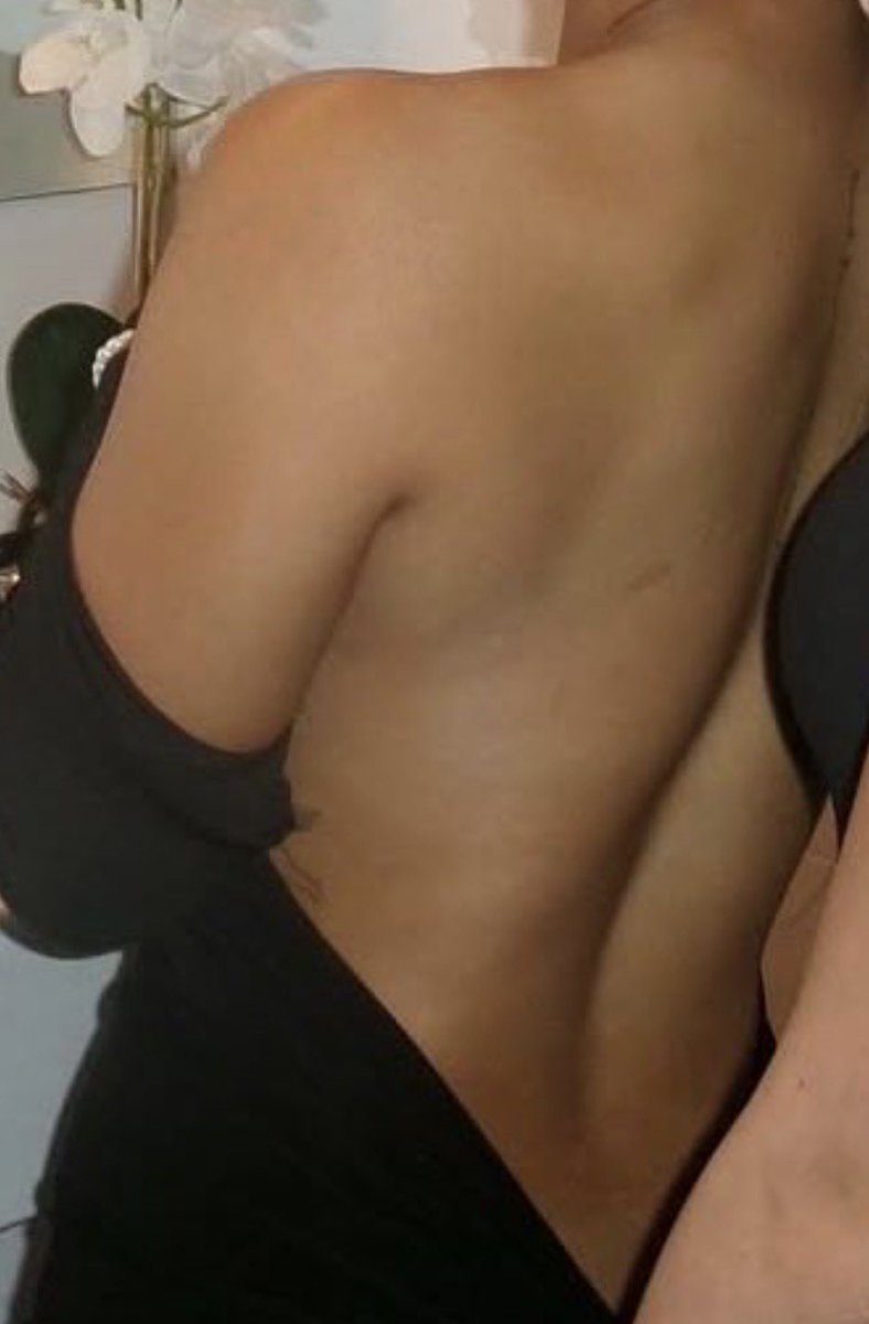 BBCXCUCKFEST tweet media