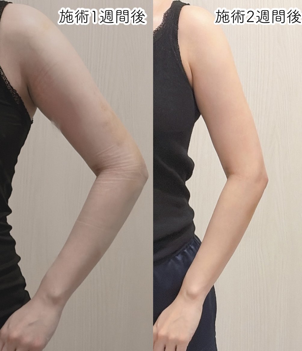 さみしゃん✈️ tweet media