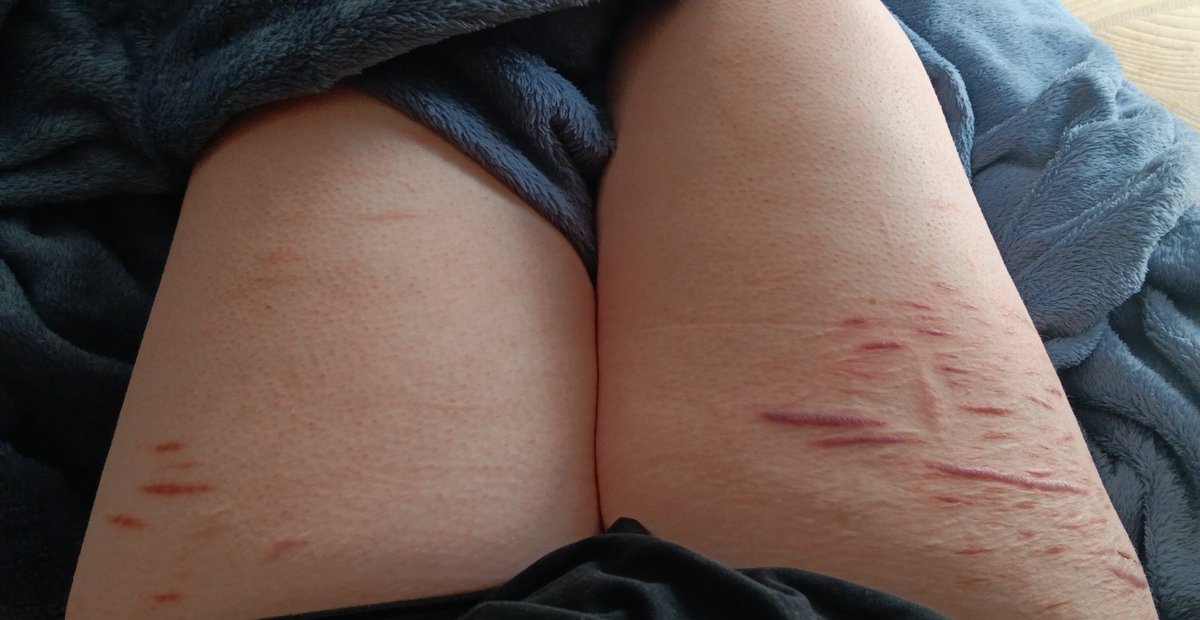 ୨ 🐇 ୧﹔ anika︐ semi active tweet media