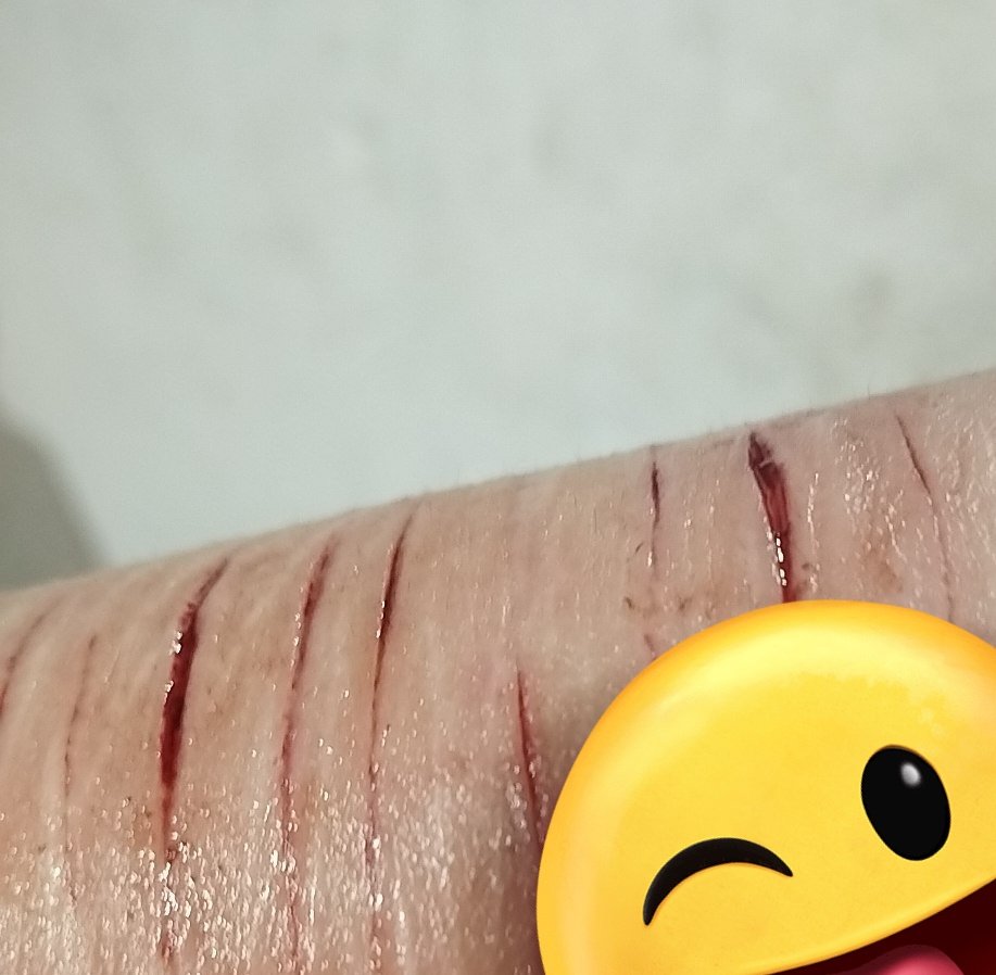 ☣︎ 𝘾𝙡𝙤𝙣𝙖𝘽𝙚𝙖𝙣☣︎ tweet media